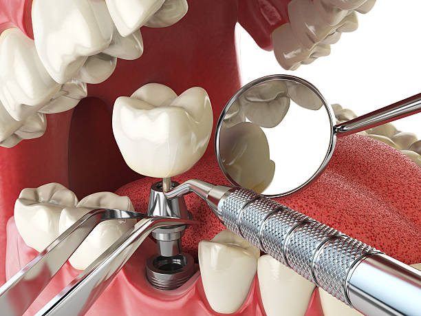 Best Holiday Emergency Dentist in Centralia, IL