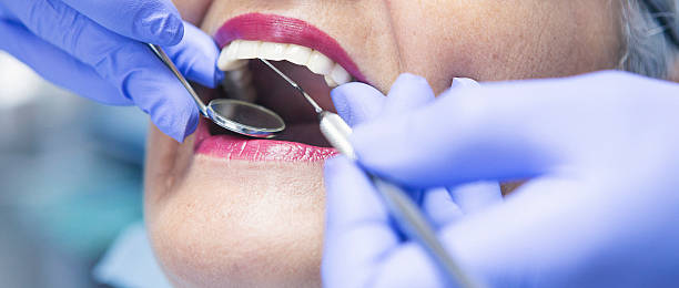 Best Emergency Dentist for Lost Fillings or Crowns in Centralia, IL